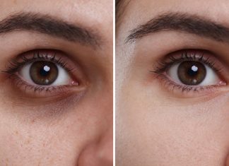 TOP 3 kremy, które ścierają fioletowe cienie pod oczami jak gumka. Możesz kupić je w ciemno