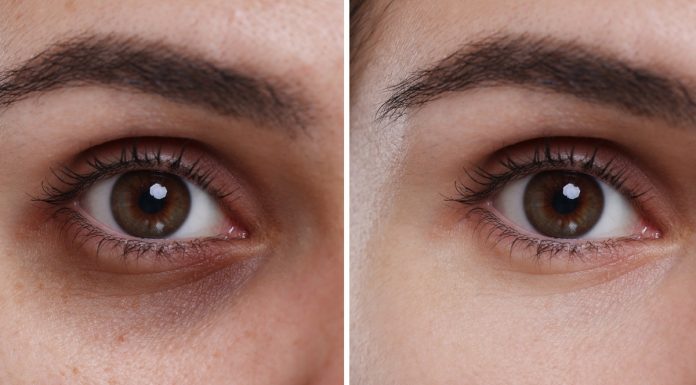 TOP 3 kremy, które ścierają fioletowe cienie pod oczami jak gumka. Możesz kupić je w ciemno