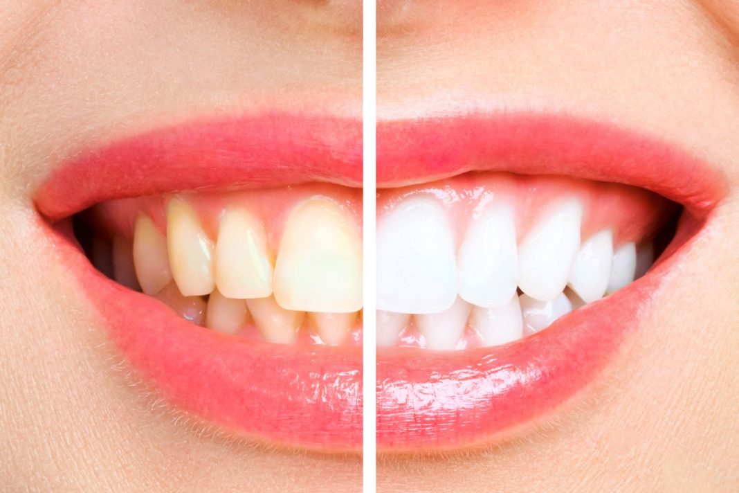 Ta wybielająca pasta powstała specjalnie z myślą o palaczach.