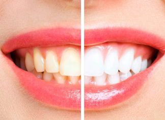 Ta wybielająca pasta powstała specjalnie z myślą o palaczach. „Odzyskałam biały uśmiech!”