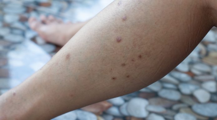 Ten krem po depilacji zapobiega wrastaniu włosków i podrażnieniom