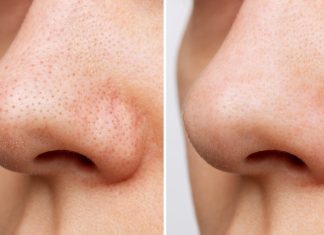 Ten produkt 3w1 zastąpi żel, maskę i peeling. Zmiata zaskórniki