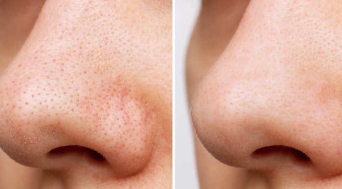 Ten produkt 3w1 zastąpi żel, maskę i peeling. Zmiata zaskórniki