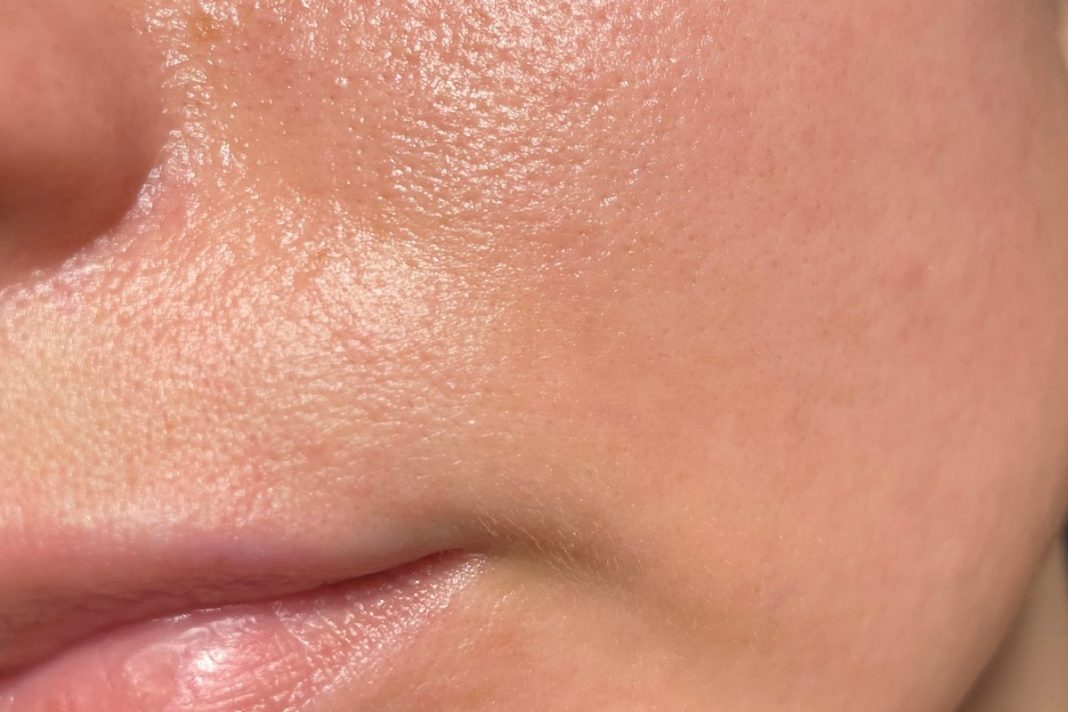 Ten lekki, tani krem to ratunek dla tłustej skóry. Zwęża pory i matuje