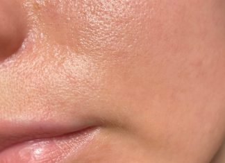 Ten lekki, tani krem to ratunek dla tłustej skóry. Zwęża pory i matuje