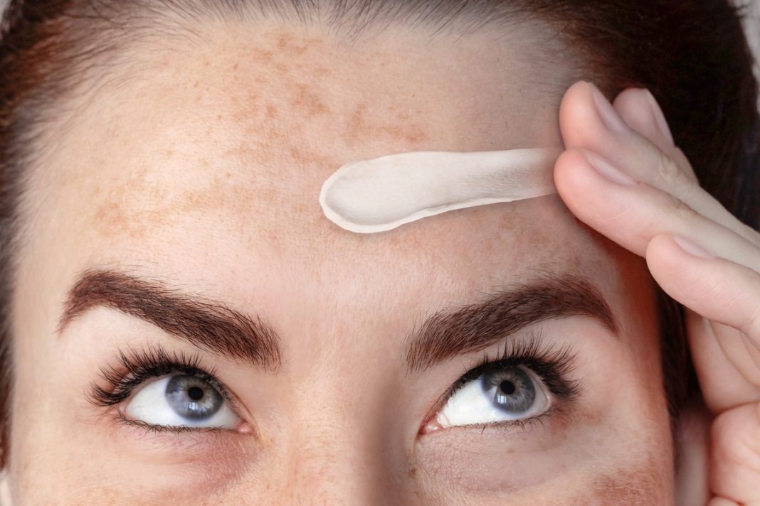 TOP 3 kremy, które działają na brązowe przebarwienia jak rozjaśniający laser