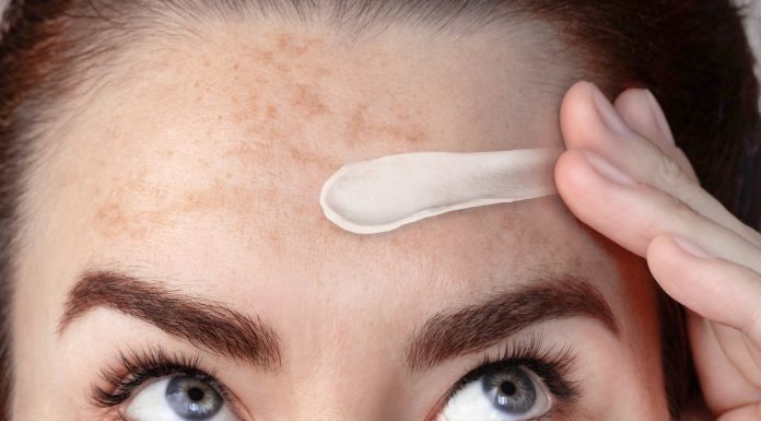 TOP 3 kremy, które działają na brązowe przebarwienia jak rozjaśniający laser