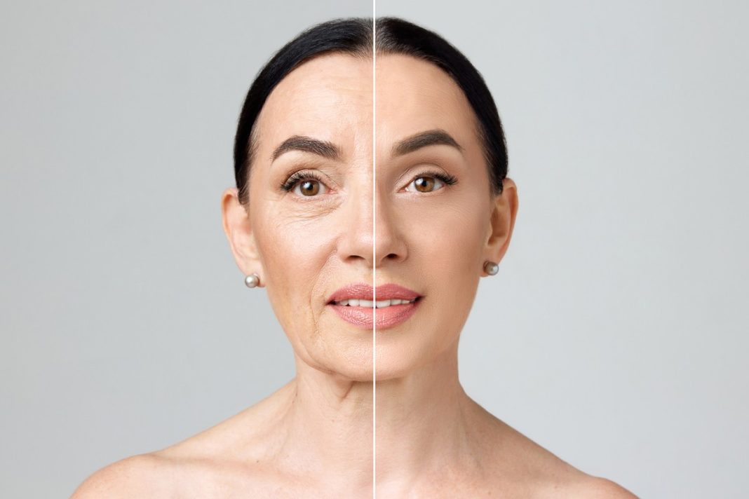 TOP 3 kremy na głębokie zmarszczki. Kosmicznie napinają skórę, zapomnisz o botoksie