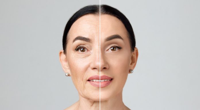 TOP 3 kremy na głębokie zmarszczki. Kosmicznie napinają skórę, zapomnisz o botoksie