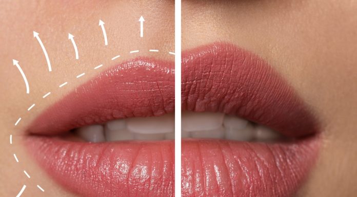 Ten płynny kolagen cudnie wypełni usta i da efekt liftingu na twarzy. Jest przeceniony o 120 zł