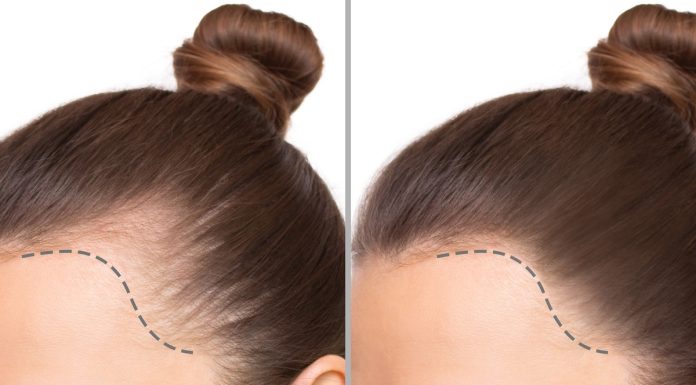 Mocny szampon na wypadające włosy z mleczkiem pszczelim. „Żałuję, że nie znałam go wcześniej”