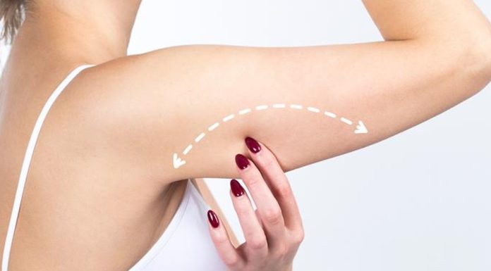 Galaretowata skóra na ramionach? Ten żel zwiększy jej elastyczność już po pierwszym użyciu