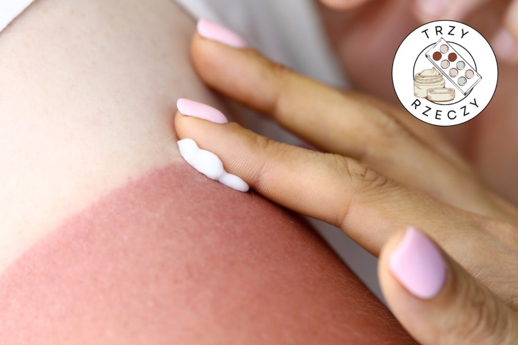 Tego szukaj w kosmetykach. Przyniosą ulgę przy pierwszych poparzeniach słonecznych