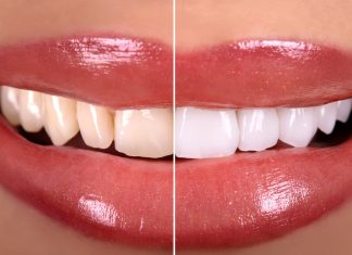 TOP 3 pasty, które wybielą zęby nawet o pięć odcieni. Są mocne jak gabinetowa lampa
