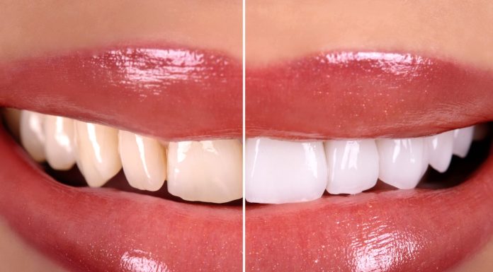 TOP 3 pasty, które wybielą zęby nawet o pięć odcieni. Są mocne jak gabinetowa lampa