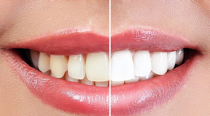 Ta tania, fioletowa pasta do zębów wybiela aż o dwa odcienie