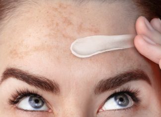 Ten mocny krem rozjaśnia uporczywe przebarwienia. Redukuje też rumień