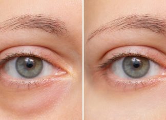 Chłodzący roll-on to rewolucja w pielęgnacji skóry pod oczami. Błyskawicznie redukuje zasinienia i opuchnięcia