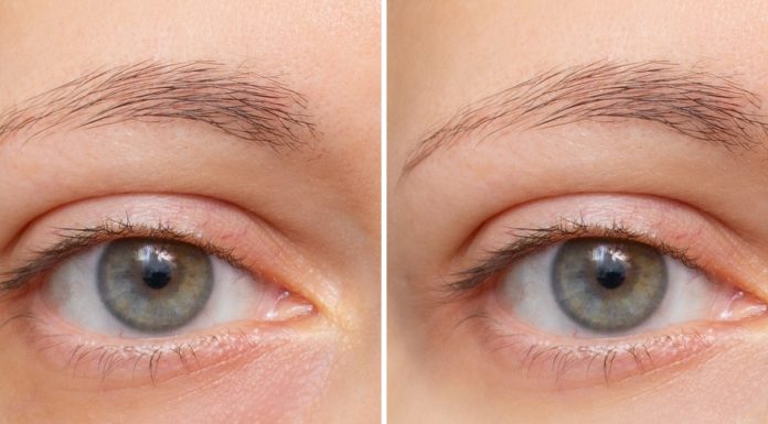 Chłodzący roll-on to rewolucja w pielęgnacji skóry pod oczami. Błyskawicznie redukuje zasinienia i opuchnięcia