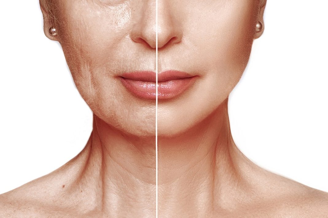 TOP 3 mocne kolageny z dodatkiem kwasu hialuronowego. Działają jak wypełniacz skóry