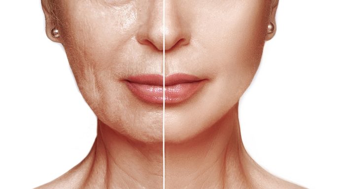 TOP 3 mocne kolageny z dodatkiem kwasu hialuronowego. Działają jak wypełniacz skóry