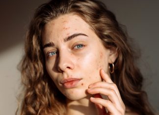 Niezawodne sposoby na blizny. Usuną nawet te, które masz już od lat