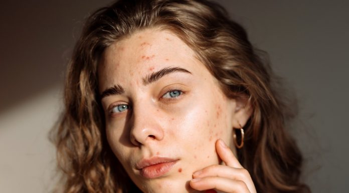 Niezawodne sposoby na blizny. Usuną nawet te, które masz już od lat