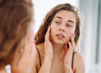 Masz wypryski na twarzy mimo odpowiedniej pielęgnacji? Powód może być błahy