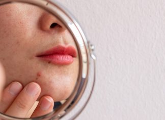 Ten kwasowy koncentrat punktowy 2w1 zmiata pryszcze w jedną noc