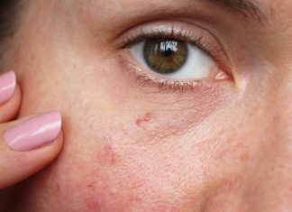 Ten tani krem uszczelnia naczynka jak laser i eliminuje pajączki. „Najlepiej wydane 16 zł”