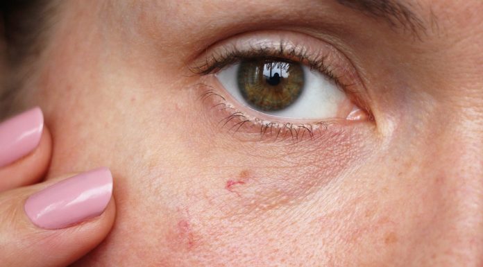 Ten tani krem uszczelnia naczynka jak laser i eliminuje pajączki. „Najlepiej wydane 16 zł”