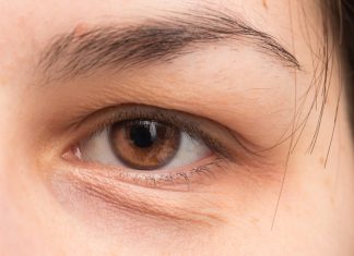 Chcesz zwalczyć worki pod oczami? Te domowe triki działają ekspresowo