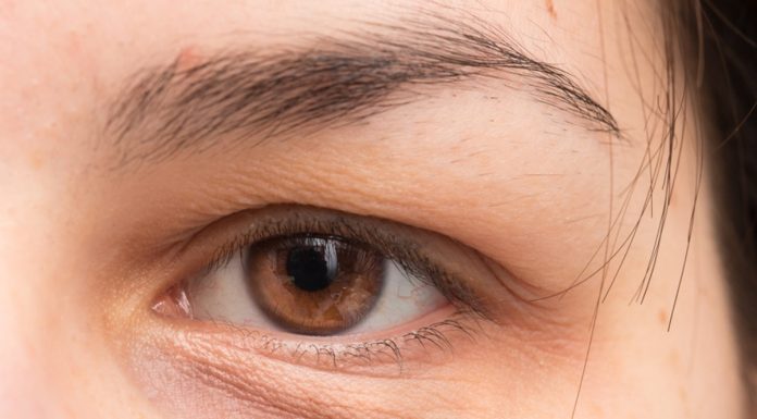 Chcesz zwalczyć worki pod oczami? Te domowe triki działają ekspresowo