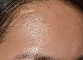 Ratunek dla tłustej cery – lekki krem zwężający pory z niacynamidem. Ogranicza sebum