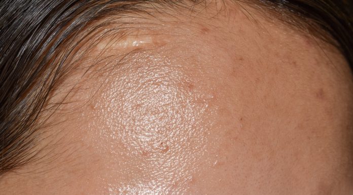 Ratunek dla tłustej cery – lekki krem zwężający pory z niacynamidem. Ogranicza sebum