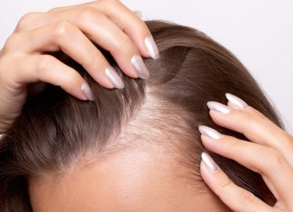 Włosy wypadają ci garściami? Oto TOP 3 szampony, które pomogą nawet na widoczne zakola