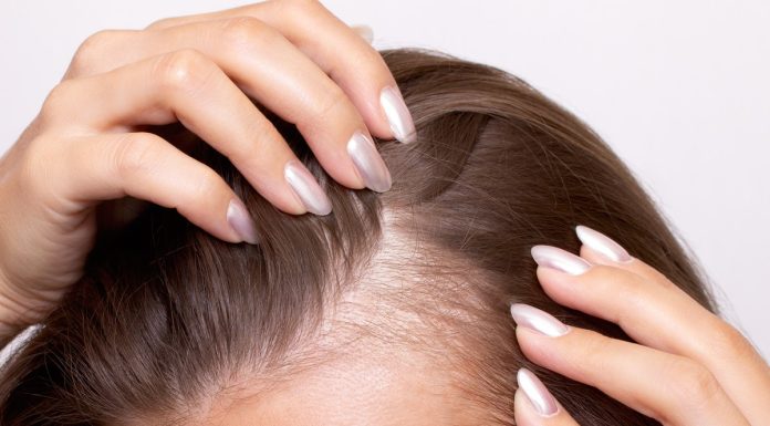 Włosy wypadają ci garściami? Oto TOP 3 szampony, które pomogą nawet na widoczne zakola