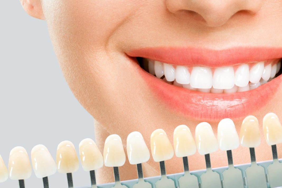 Ulubiona pasta kawoszy teraz jest przeceniona. Ściera żółty kolor jak gumka