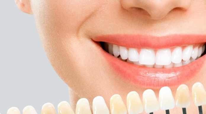 Ulubiona pasta kawoszy teraz jest przeceniona. Ściera żółty kolor jak gumka