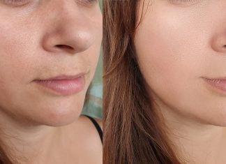 To serum jest jak szklanka cytrusowego koktajlu dla cery – rozprawi się z przebarwieniami