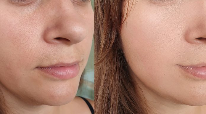 To serum jest jak szklanka cytrusowego koktajlu dla cery – rozprawi się z przebarwieniami