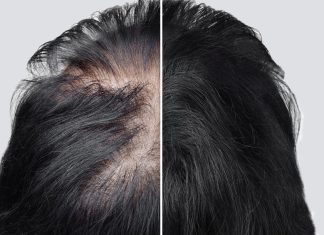 Turbo wcierka! To jest witaminowa bomba dla twoich włosów. Mocno je zagęszcza