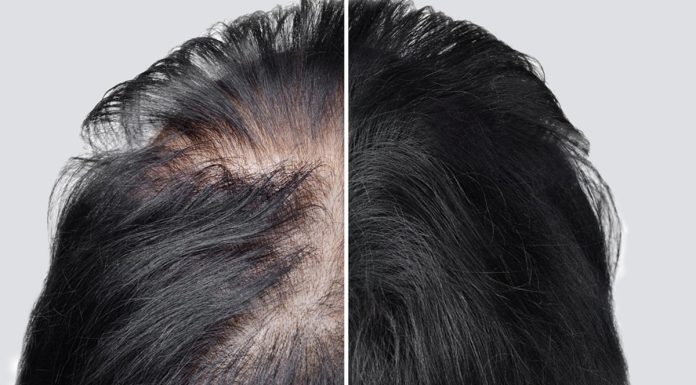 Turbo wcierka! To jest witaminowa bomba dla twoich włosów. Mocno je zagęszcza