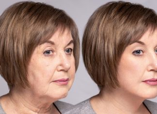 Siła kosmetycznych nici. Zagęszczają i napinają skórę jak szalone. Efekty? Zwalają z nóg