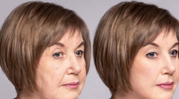 Siła kosmetycznych nici. Zagęszczają i napinają skórę jak szalone. Efekty? Zwalają z nóg