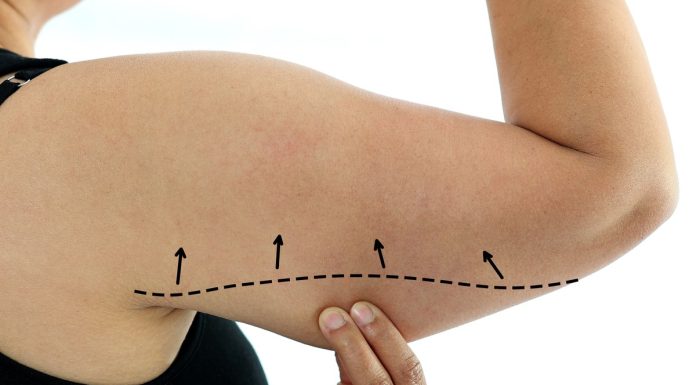 Najmocniejszy koncentrat napinający luźną skórę na ramionach. „Pożegnałam pelikany!”