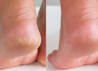 Te kremy do stóp mają wysokie stężenie mocznika. Wygładzają nawet bardzo szorstkie pięty