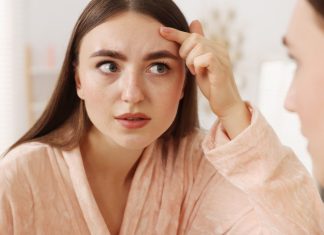 Co oznaczają wypryski na linii włosów? Tak można z nimi walczyć
