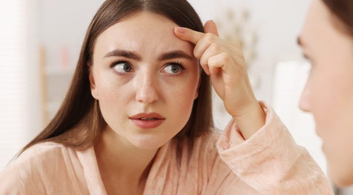 Co oznaczają wypryski na linii włosów? Tak można z nimi walczyć