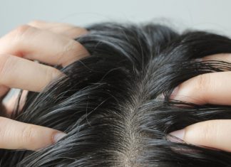 Swędzenie i łupież zniknęły po pierwszym użyciu! Ten szampon to ratunek dla wrażliwego skalpu